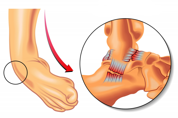 脛 腓 靭帯 前 【機能解剖学各論】足関節の主要６靭帯